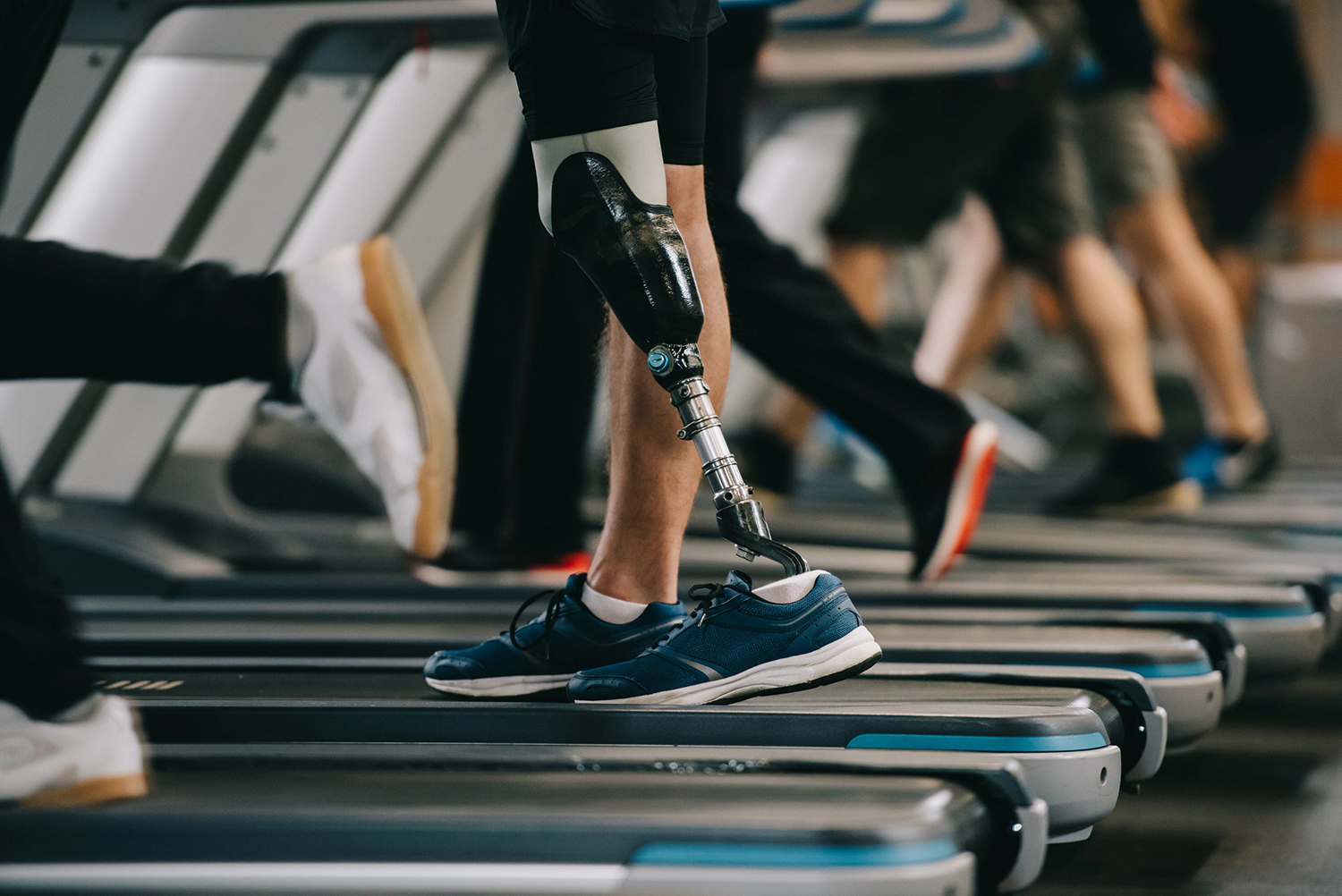 Modern prosthetic legs are manufactured from lightweight materials that enable easier walking, and for some, can even make activities like running possible. (Image Source: AdobeStock_232970923)